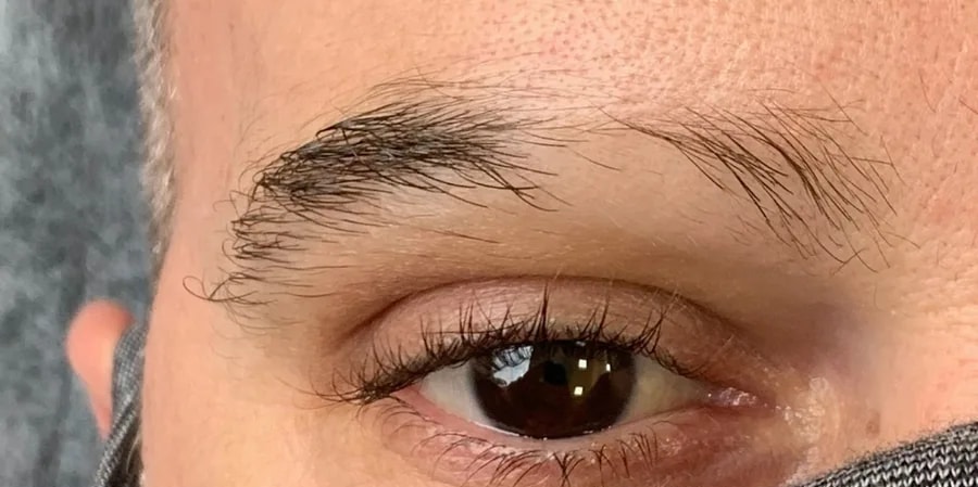 Sobrancelha antes do procedimento