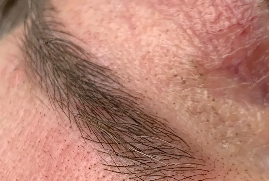 Resultado de nanopigmentação, em close