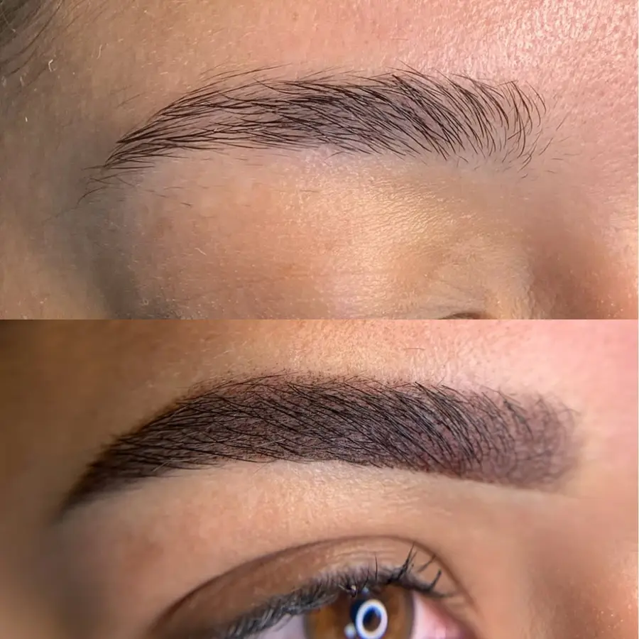 Antes e depois de procedimento — aluna Jay Academy