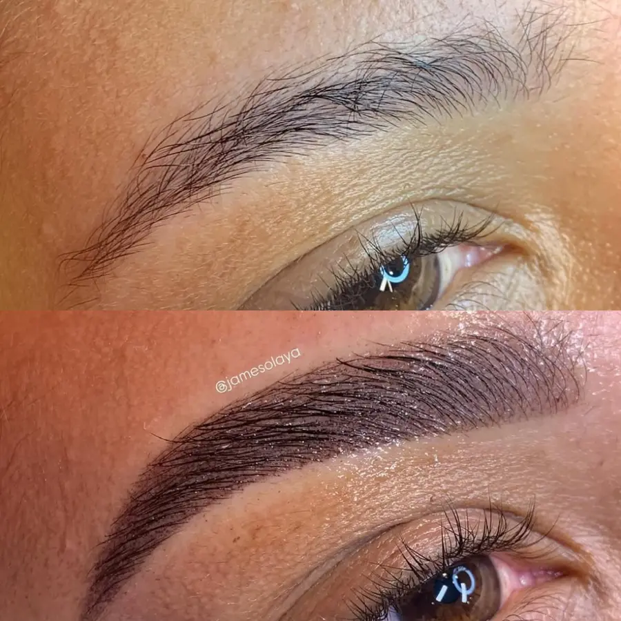 Antes e depois de procedimento — aluna Jay Academy