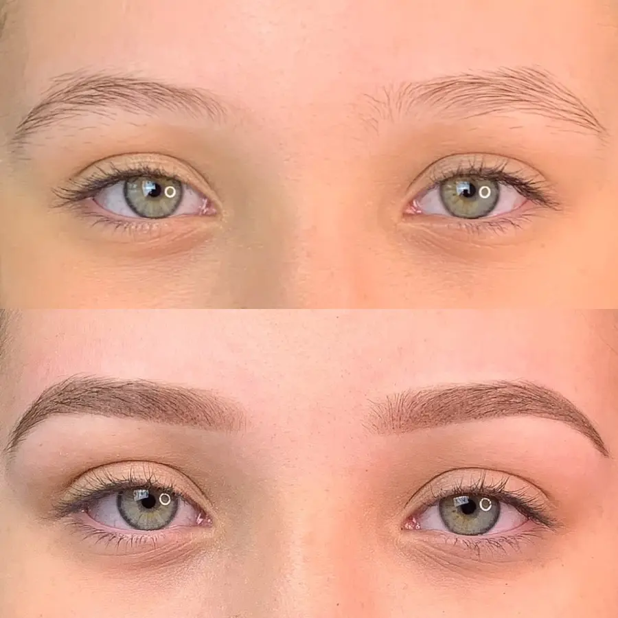 Antes e depois de procedimento — aluna Jay Academy
