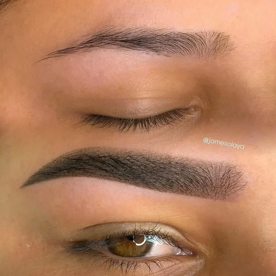 Antes e depois de procedimento — aluna Jay Academy